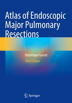 Atlas of Endoscopic Major Pulmonary Resections - Gossot, Dominique