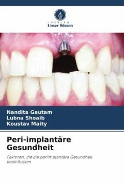 Peri-implantäre Gesundheit - Gautam, Nandita;Shoaib, Lubna;Maity, Koustav