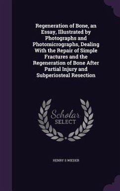 Regeneration of Bone, an Essay, Illustrated by Photographs and Photomicrographs, Dealing With the Repair of Simple Fractures and the Regeneration of Bone After Partial Injury and Subperiosteal Resection - Wieder, Henry S