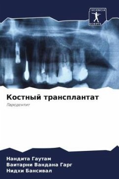 Cover Kostnyj transplantat