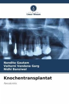 Knochentransplantat - Gautam, Nandita;Garg, Vaitarni Vandana;Bansiwal, Nidhi