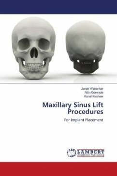 Maxillary Sinus Lift Procedures