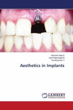 Aesthetics in Implants