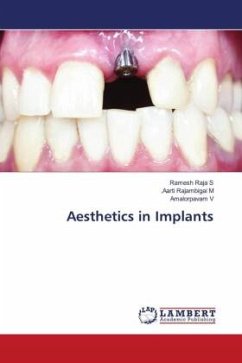 Aesthetics in Implants - Raja S, Ramesh;Rajambigai M, .Aarti;V, Amalorpavam