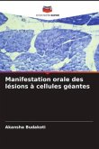 Manifestation orale des lésions à cellules géantes