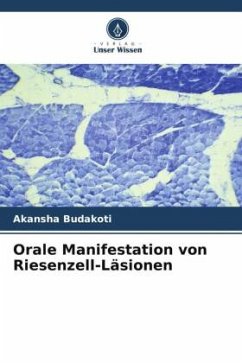 Orale Manifestation von Riesenzell-Läsionen - Budakoti, Akansha