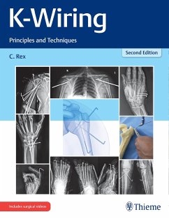 K-Wiring - Rex, Chandrabose