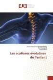 Les scolioses évolutives de l¿enfant