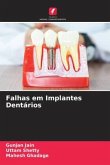 Falhas em Implantes Dentários