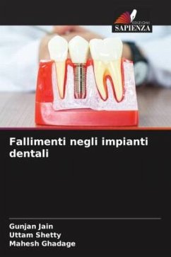 Fallimenti negli impianti dentali - Jain, Gunjan;Shetty, Uttam;Ghadage, Mahesh