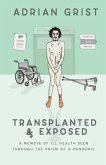 Transplanted & Exposed (eBook, ePUB)