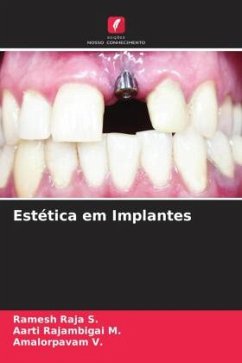 Estética em Implantes - Raja S., Ramesh;Rajambigai M., Aarti;V., Amalorpavam