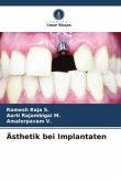 Ästhetik bei Implantaten