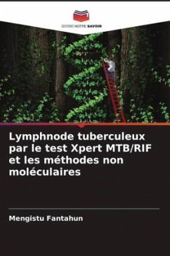 Lymphnode tuberculeux par le test Xpert MTB/RIF et les méthodes non moléculaires - Fantahun, Mengistu