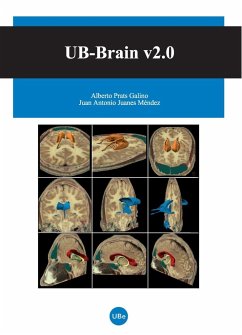 UB-Brain v2.0 - Juanes Méndez, Juan Antonio; Prats Galino, Alberto