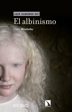 El albinismo - Montoliu José, Lluís
