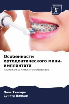 Osobennosti ortodonticheskogo mini-implantata - Thakare, Pooq;Daokar, Suchita