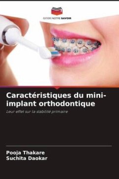 Caractéristiques du mini-implant orthodontique - Thakare, Pooja;Daokar, Suchita