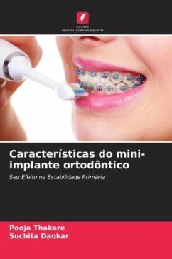 Características do mini-implante ortodôntico - Thakare, Pooja;Daokar, Suchita