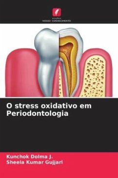 O stress oxidativo em Periodontologia - Dolma J., Kunchok;Gujjari, Sheela kumar