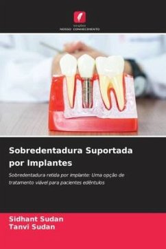 Sobredentadura Suportada por Implantes - Sudan, Sidhant;Sudan, Tanvi