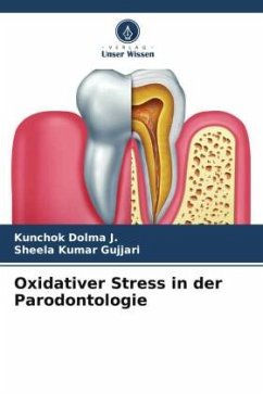 Oxidativer Stress in der Parodontologie - Dolma J., Kunchok;Gujjari, Sheela kumar