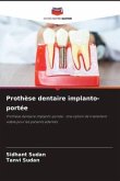 Prothèse dentaire implanto-portée