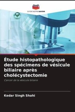 Étude histopathologique des spécimens de vésicule biliaire après cholécystectomie - Shahi, Kedar Singh;Shukla, Sanjeev Kumar