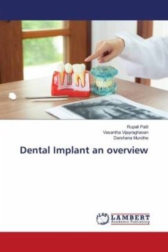 Dental Implant an overview - Patil, Rupali;Vijayraghavan, Vasantha;Mundhe, Darshana