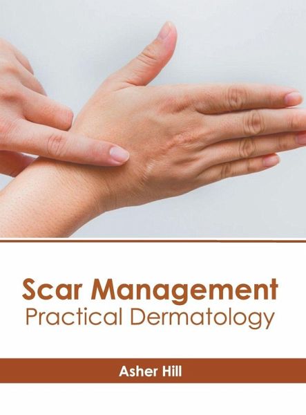 Scar Management: Practical Dermatology Scar Management: Practical Dermatology