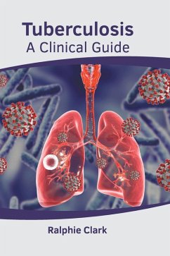 Cover Tuberculosis: A Clinical Guide