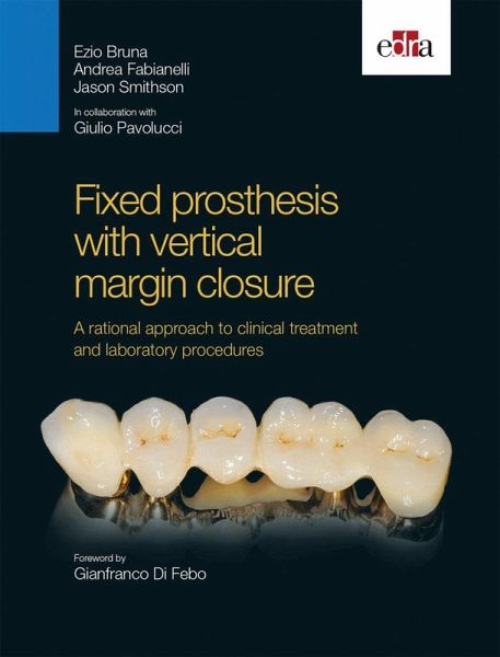 Fixed Prosthesis with Vertical Margin Closure. a Rational Approach to Clinical Treatment and Laboratory Procedures Fixed Prosthesis with Vertical Margin Closure. a Rational Approach to Clinical Treatment and Laboratory Procedures