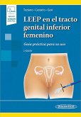LEEP en el tracto genital inferior femenino. . Guía práctica para su uso. (Incluye versión digital)