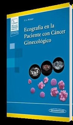 Ecografía en la Paciente con Cáncer Ginecológico (+ e-book)