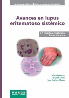 Avances en lupus eritematoso sistémico - Latinoamérica - Jiménez Alonso, Juan; Cervera, Ricard