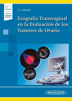 Ecografía transvaginal en la evaluación de los tumores de ovario - Alcázar Zambrano, Juan Luis