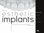 Esthetic Implants How to Think about Complex Cases in Anterior Areas with a Global Approach to the Patient Smile (2 Books) Esthetic Implants How to Think about Complex Cases in Anterior Areas with a Global Approach to the Patient Smile (2 Books)