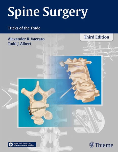 Spine Surgery (eBook, ePUB) Spine Surgery (eBook, ePUB)