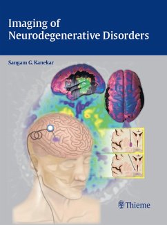 Imaging of Neurodegenerative Disorders (eBook, ePUB)