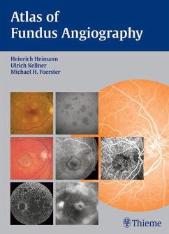 Atlas of Fundus Angiography (eBook, PDF)