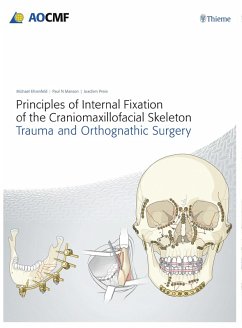 Principles of Internal Fixation of the Craniomaxillofacial Skeleton (eBook, PDF) - Prein, Joachim; Ehrenfeld, Michael; Manson, Paul N.
