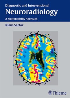 Diagnostic and Interventional Neuroradiology (eBook, PDF) - Sartor, Klaus