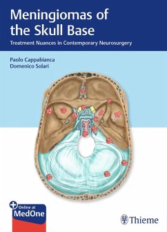 Meningiomas of the Skull Base (eBook, PDF)