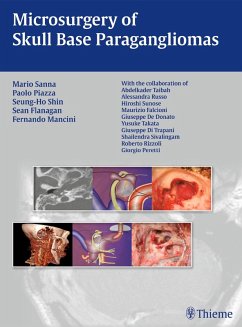 Microsurgery of Skull Base Paragangliomas (eBook, PDF) - Piazza, Paolo; Shin, Seung-Ho; Flanagan, Sean; Sanna, Mario; Mancini, Fernando