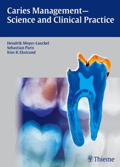 Caries Management - Science and Clinical Practice (eBook, PDF)