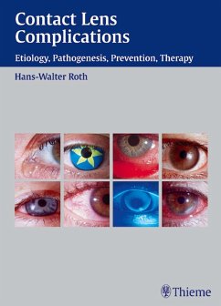 Contact Lens Complications (eBook, PDF) - Roth, Hans-Walter