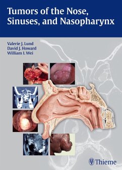 Tumors of the Nose, Sinuses and Nasopharynx (eBook, PDF) - Lund, Valerie J.; Howard, David; Wei, William I.