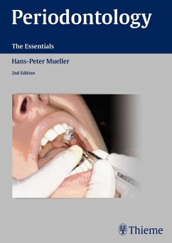 Periodontology (eBook, PDF) - Müller, Hans-Peter