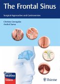 The Frontal Sinus (eBook, PDF)