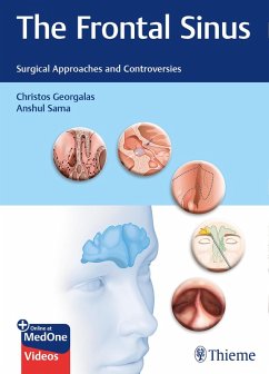Cover The Frontal Sinus (eBook, PDF)